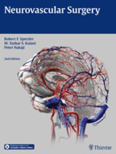 メディカルブックサービス　Neurovascular　Surgery.2nd.　online　shop