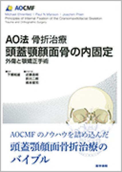 online　頭蓋顎顔面骨の内固定　AO法骨折治療　メディカルブックサービス　外傷と顎矯正手術　shop