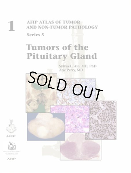 画像1: Tumors of the Pituitary Gland（AFIP Atlas of Tumor & Non-Tumor Pathology, 5th Series,Fascicle 1） (1)