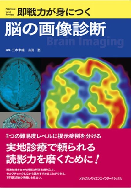 画像1: 即戦力が身につく脳の画像診断 (1)