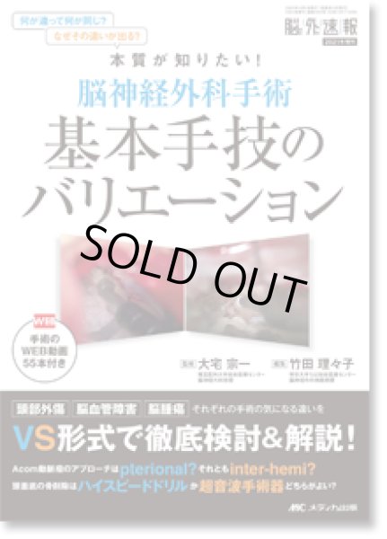 画像1: 脳神経外科手術 基本手技のバリエーション 【脳神経外科速報 2021年増刊】 (1)