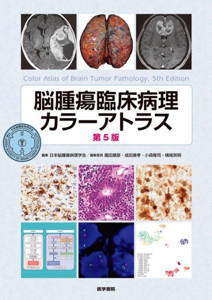 画像1: 脳腫瘍臨床病理カラーアトラス　第5版 (1)