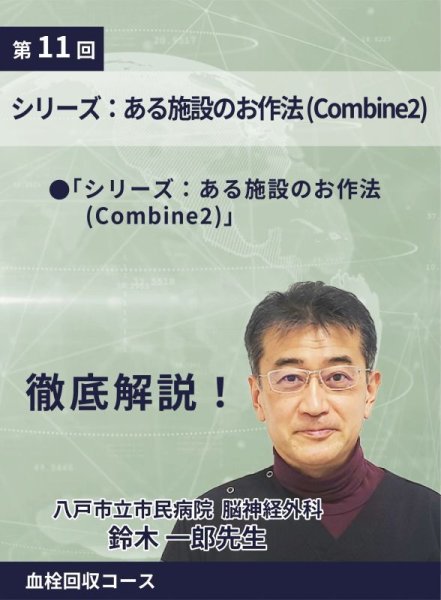 画像1: 動画≫≫≫ GSNET 血栓回収コース11 『 シリーズ：ある施設のお作法 (Combine2』 (1)