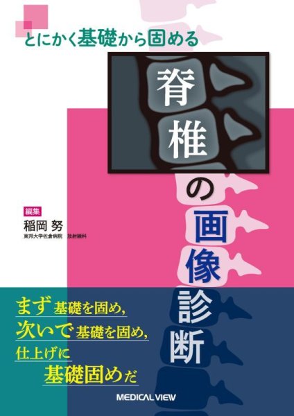 画像1: とにかく基礎から固める  脊椎の画像診断 (1)