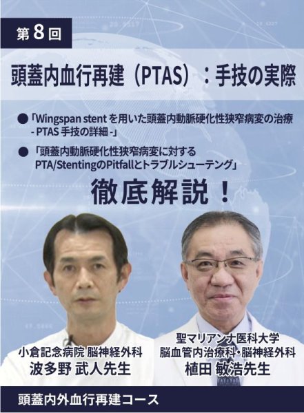 画像1: 動画≫≫≫ GSNET 頭蓋内外血行再建コース8️⃣「頭蓋内血行再建（PTAS）：手技の実際」 (1)