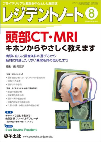 画像1: 【レジデントノート 2024年08月号】頭部CT・MRI　キホンからやさしく教えます (1)