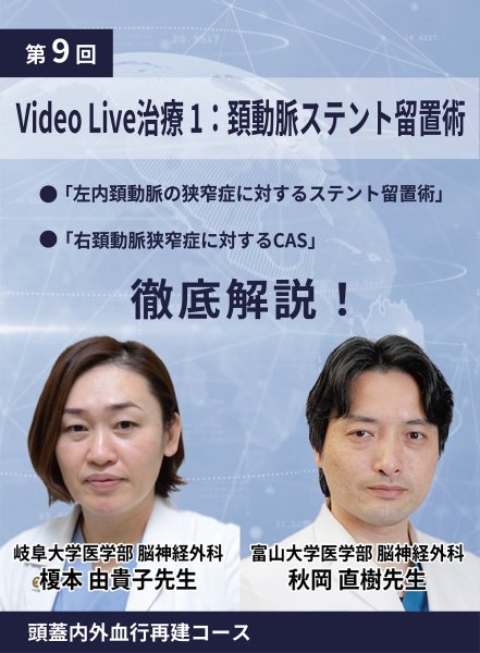 画像1: 動画≫≫≫ GSNET 頭蓋内外血行再建コース9️⃣　Video Live 1：頚動脈ステント留置術 (1)