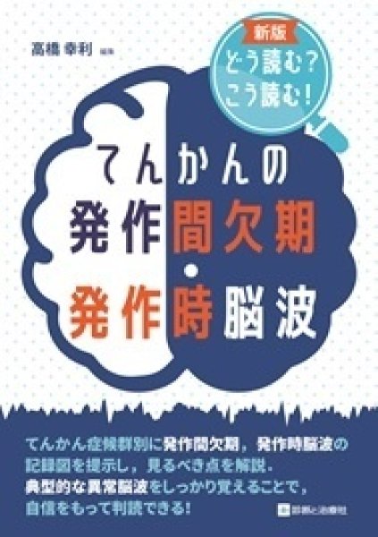 画像1: 新版　どう読む？こう読む！ てんかんの発作間欠期・発作時脳波 (1)