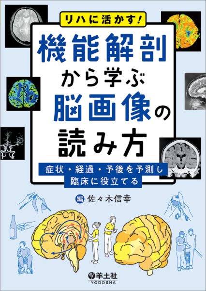 画像1: リハに活かす！機能解剖から学ぶ脳画像の読み方 (1)