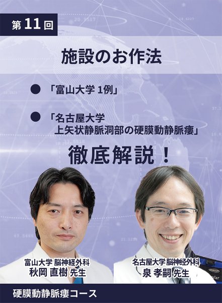 画像1: 動画≫≫≫ GSNET 硬膜動静脈瘻コース11 施設のお作法（名古屋大学/富山大学 症例Video） (1)