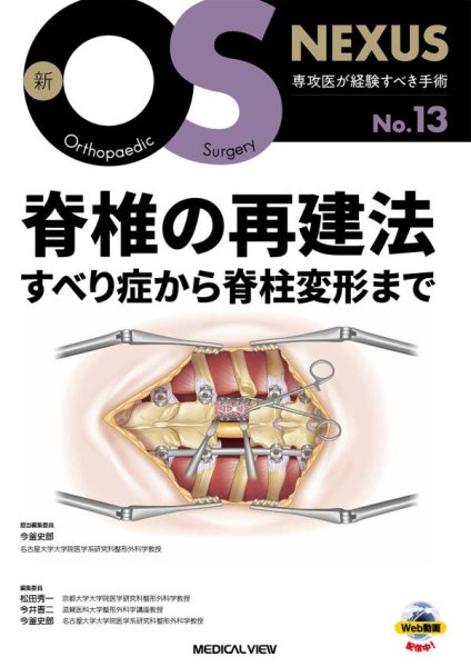 画像1: 新OS NEXUS No.13  脊椎の再建法—すべり症から脊柱変形まで ［Web動画付］ (1)