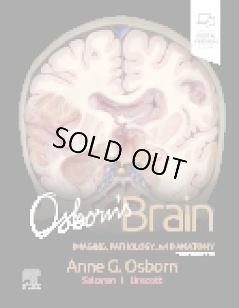 画像1: Osborn's Brain, 3rd Edition (1)