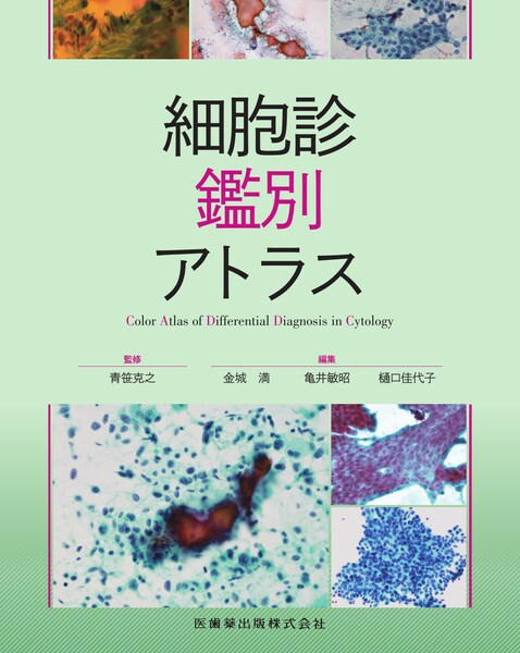 細胞診鑑別アトラス - メディカルブックサービス online shop
