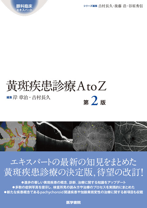 [眼科臨床エキスパート]　第2版　黄斑疾患診療AtoZ　shop　メディカルブックサービス　online