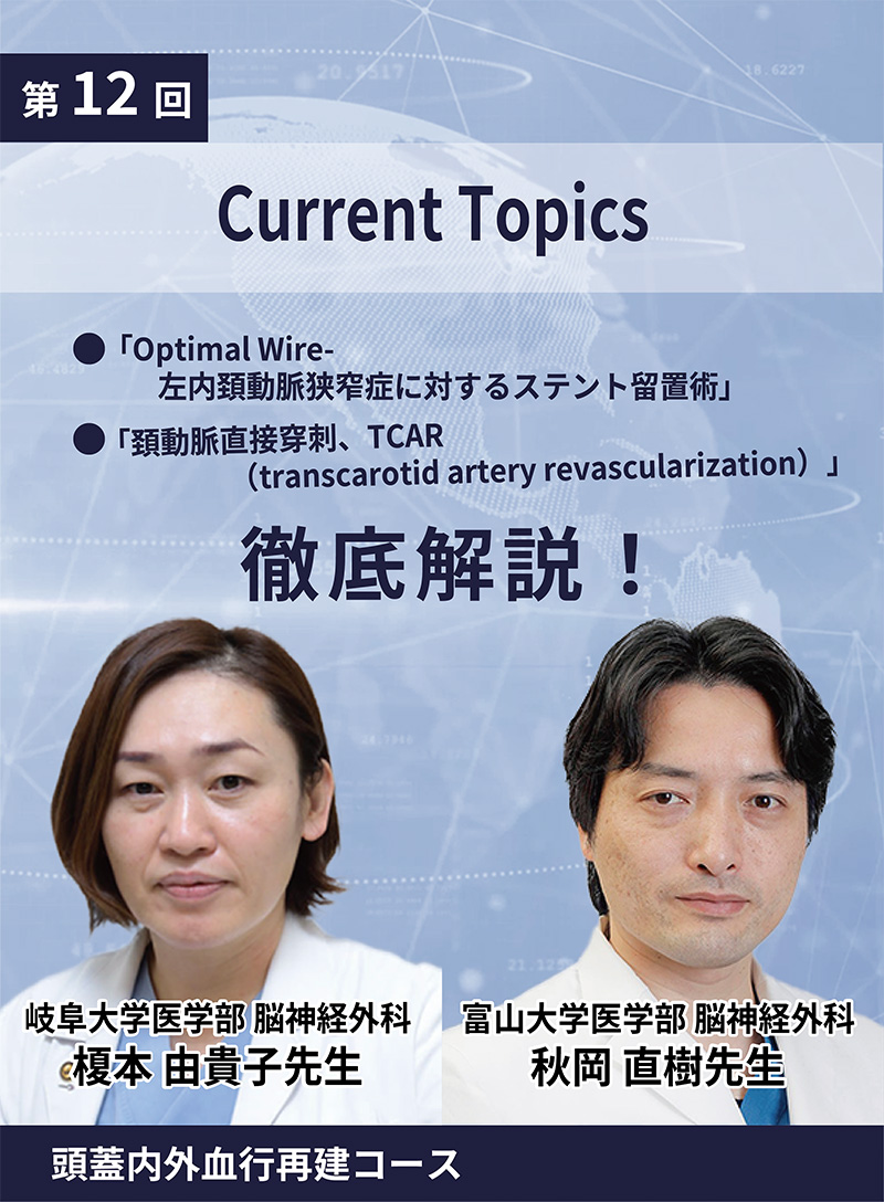 動画≫≫≫ GSNET 頭蓋内外血行再建コース12 Current Topics（頚動脈直接穿刺、TCAR（transcarotid artery revascularization）