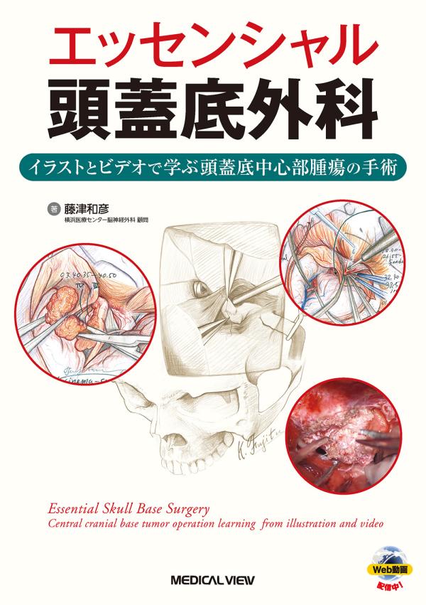 エッセンシャル頭蓋底外科 ［Web動画付］ イラストとビデオで学ぶ頭蓋底中心部腫瘍の手術