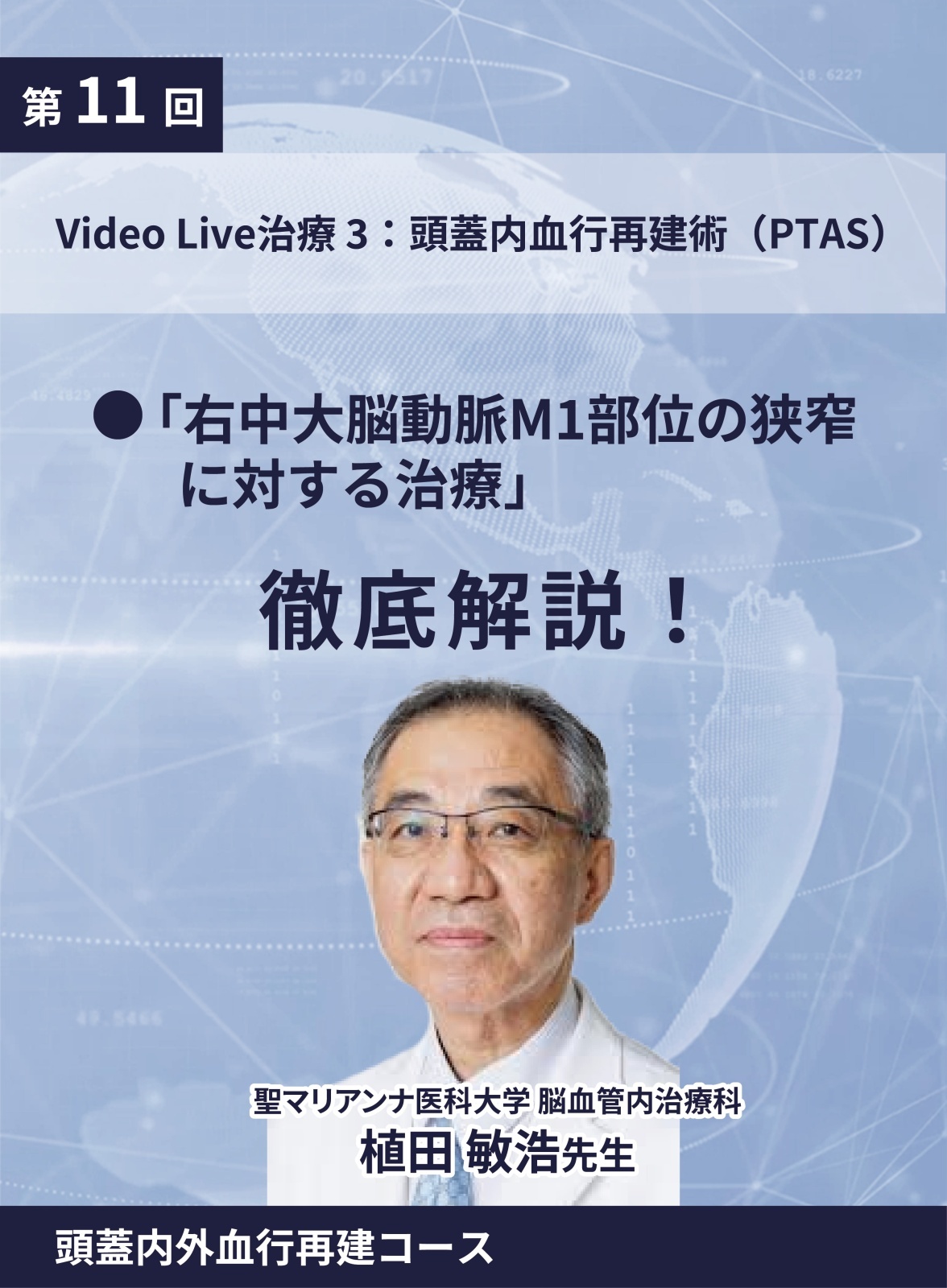 動画≫≫≫ GSNET 頭蓋内外血行再建コース11 症例Video 3：頭蓋内血行再建術（PTAS）